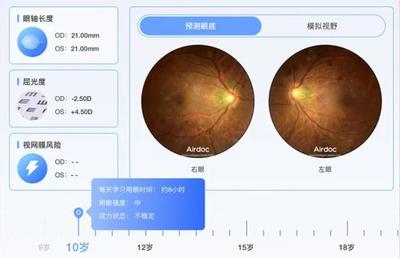 鷹瞳科技發(fā)布新一代AI眼底相機(jī)AFC，全方位守護(hù)視力健康